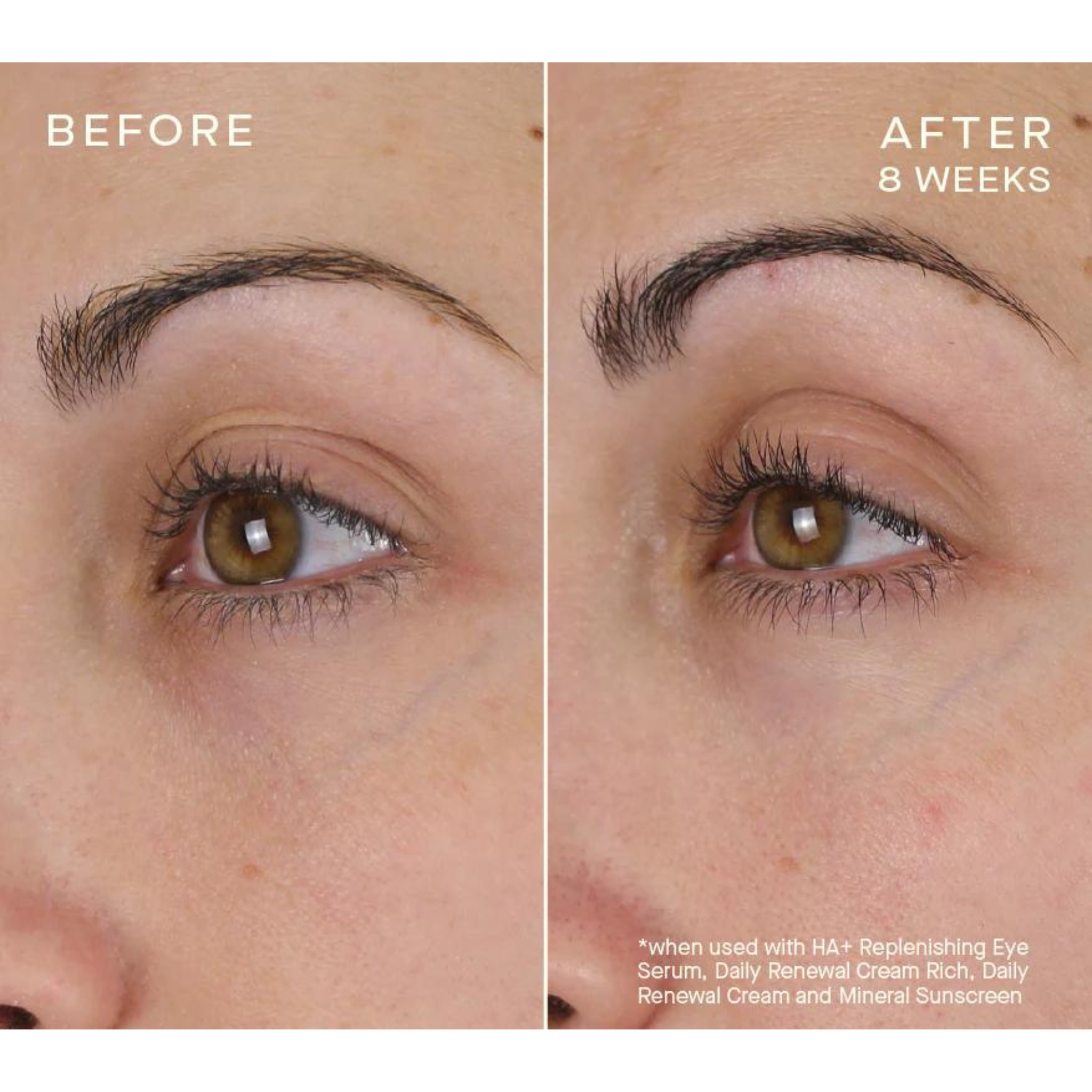 Filler Un-Jection Duo Gift Set | Ourself