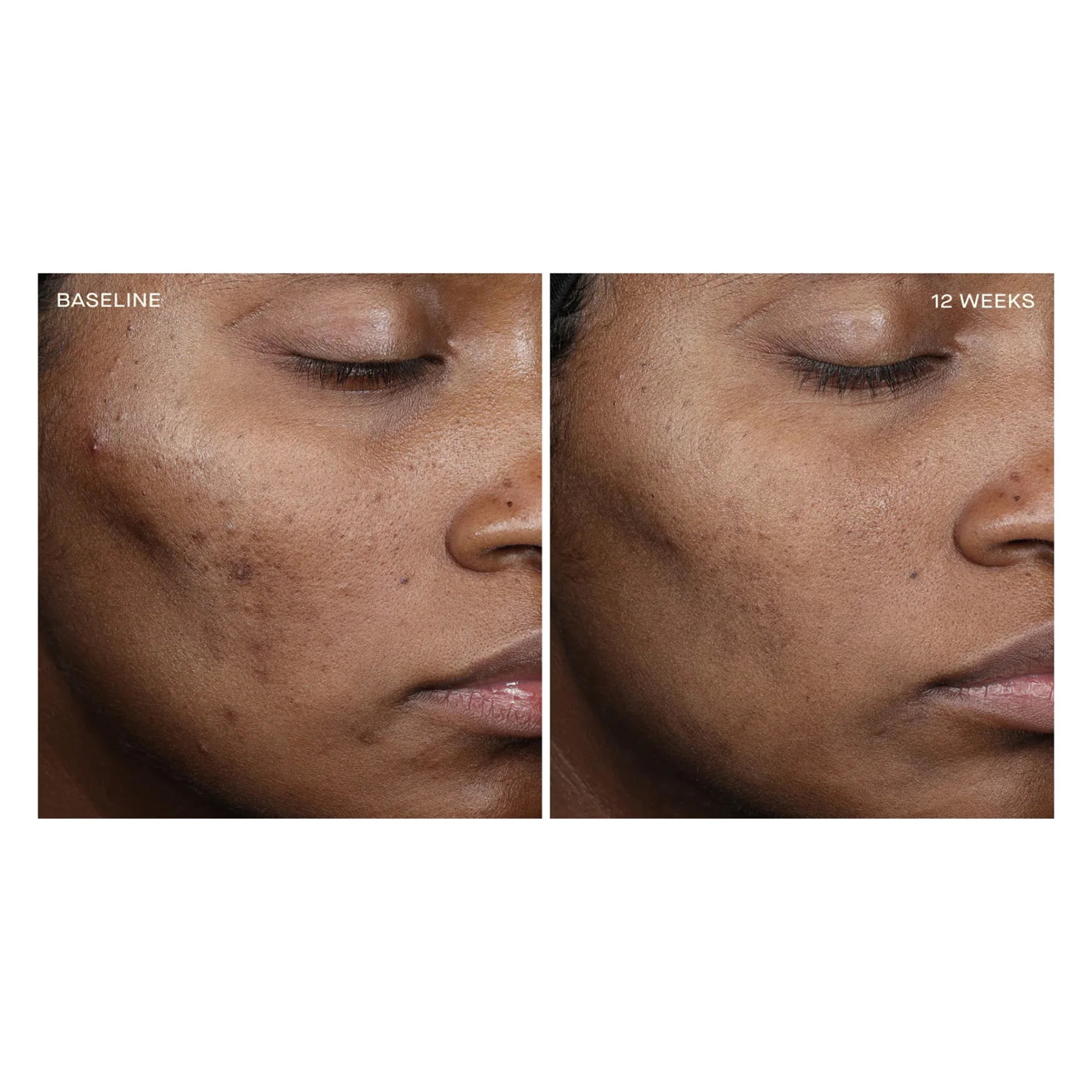 Complexion Brightening Serum | Ourself
