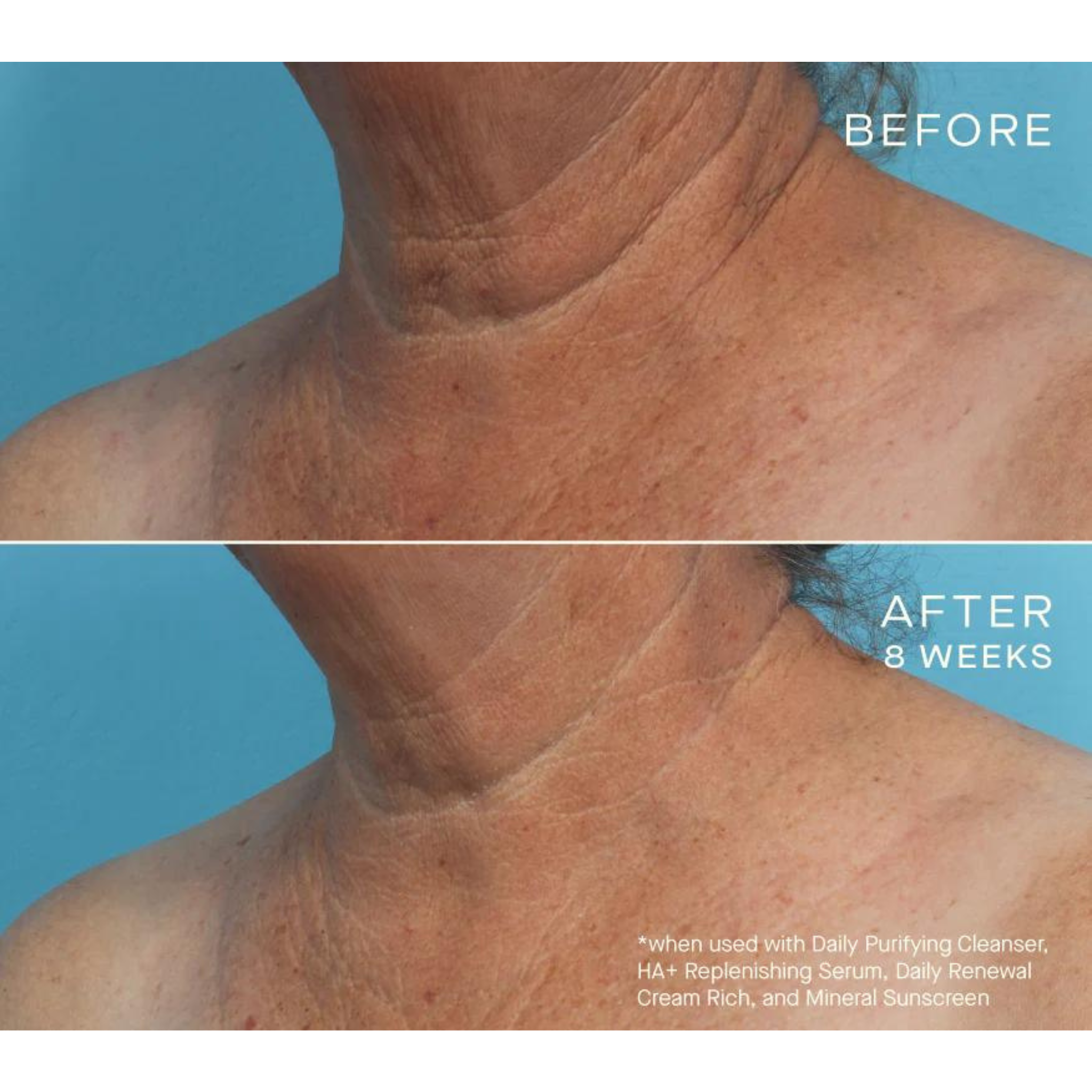 HA+ Replenishing Serum | Ourself