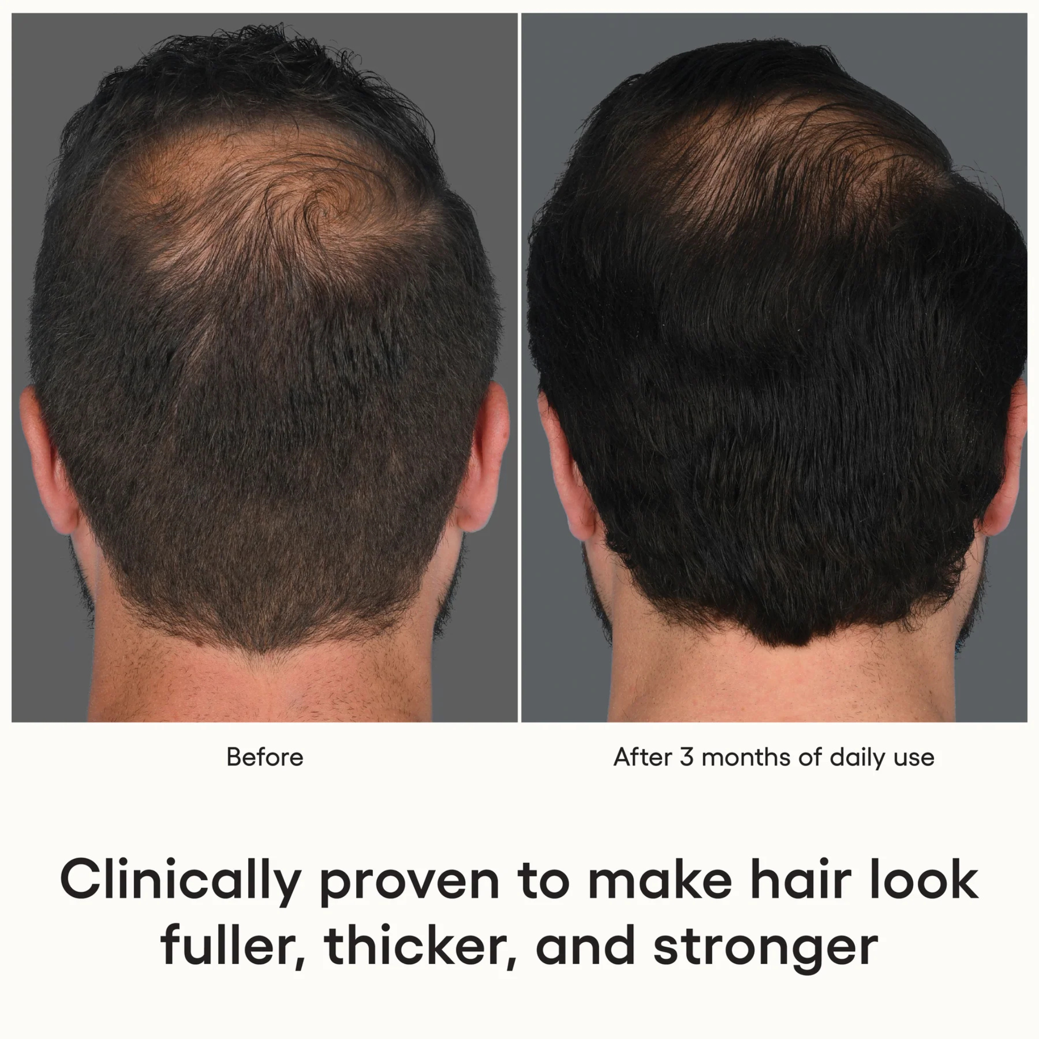 Hair Serum | ( plated )™ Skin Science