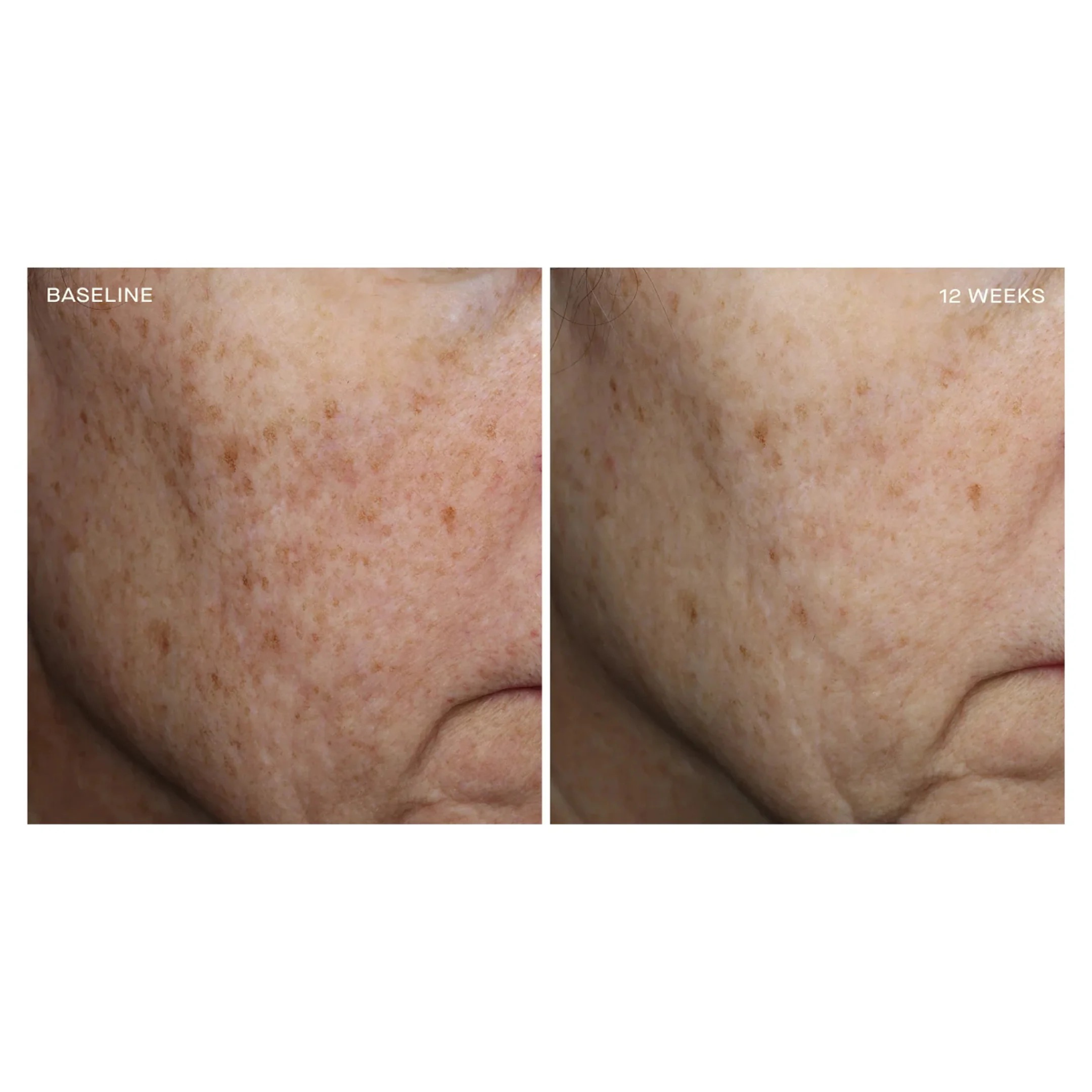 Complexion Brightening Serum | Ourself