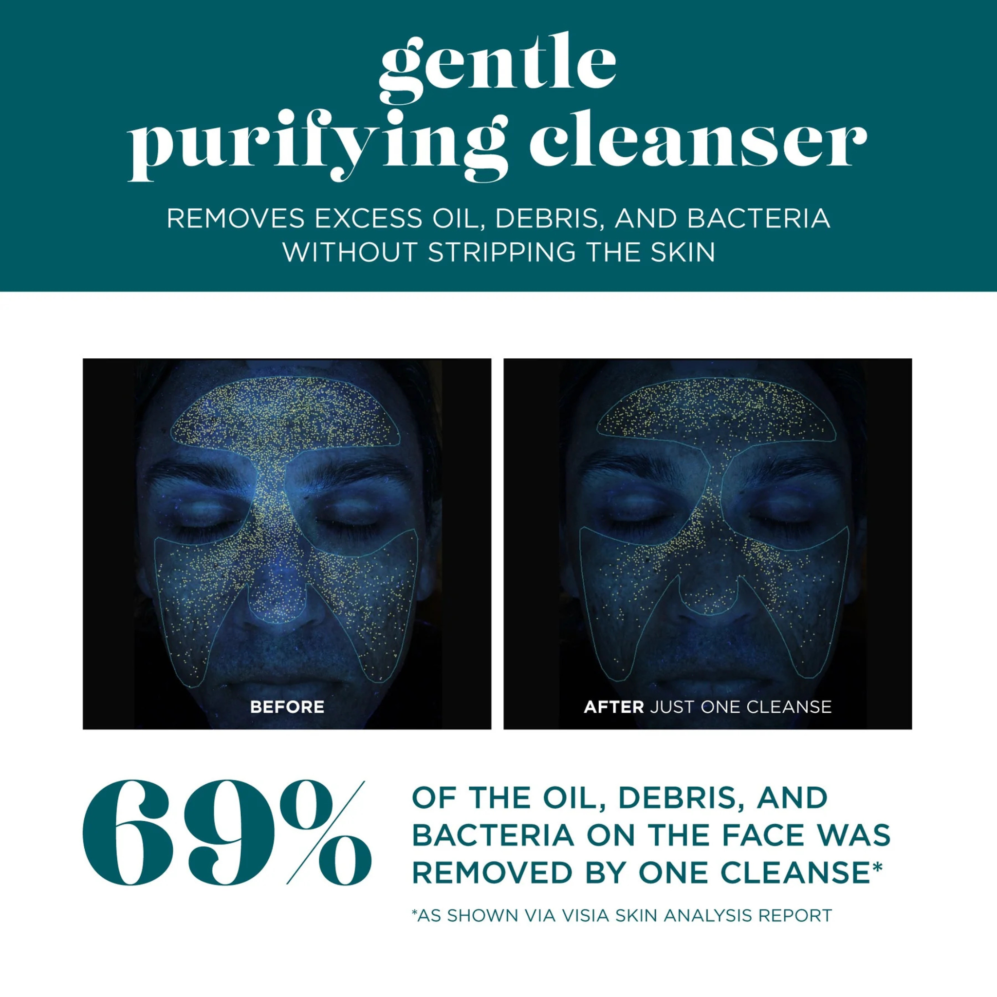 Gentle Purifying Cleanser | VI Derm