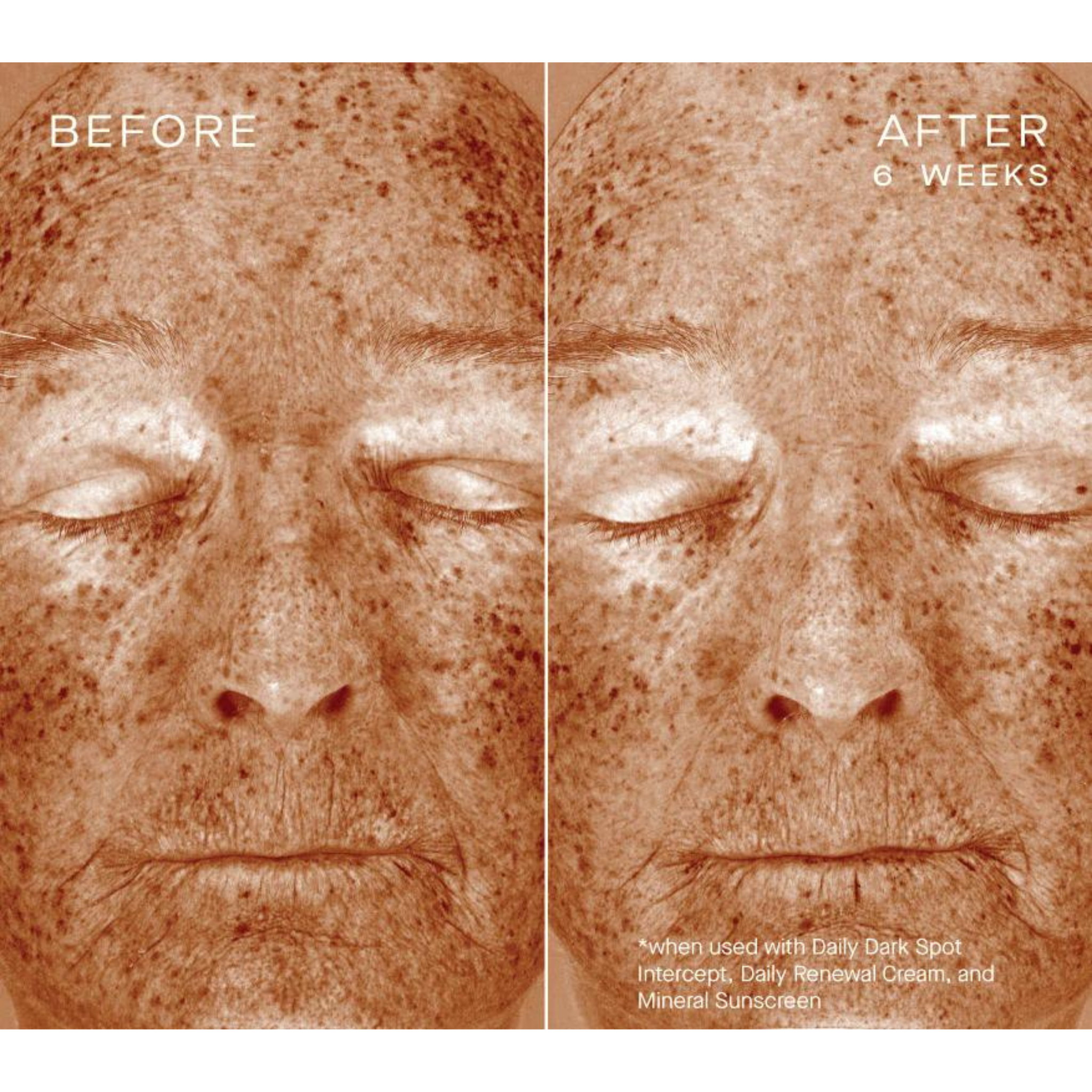 Daily Dark Spot Intercept | Ourself